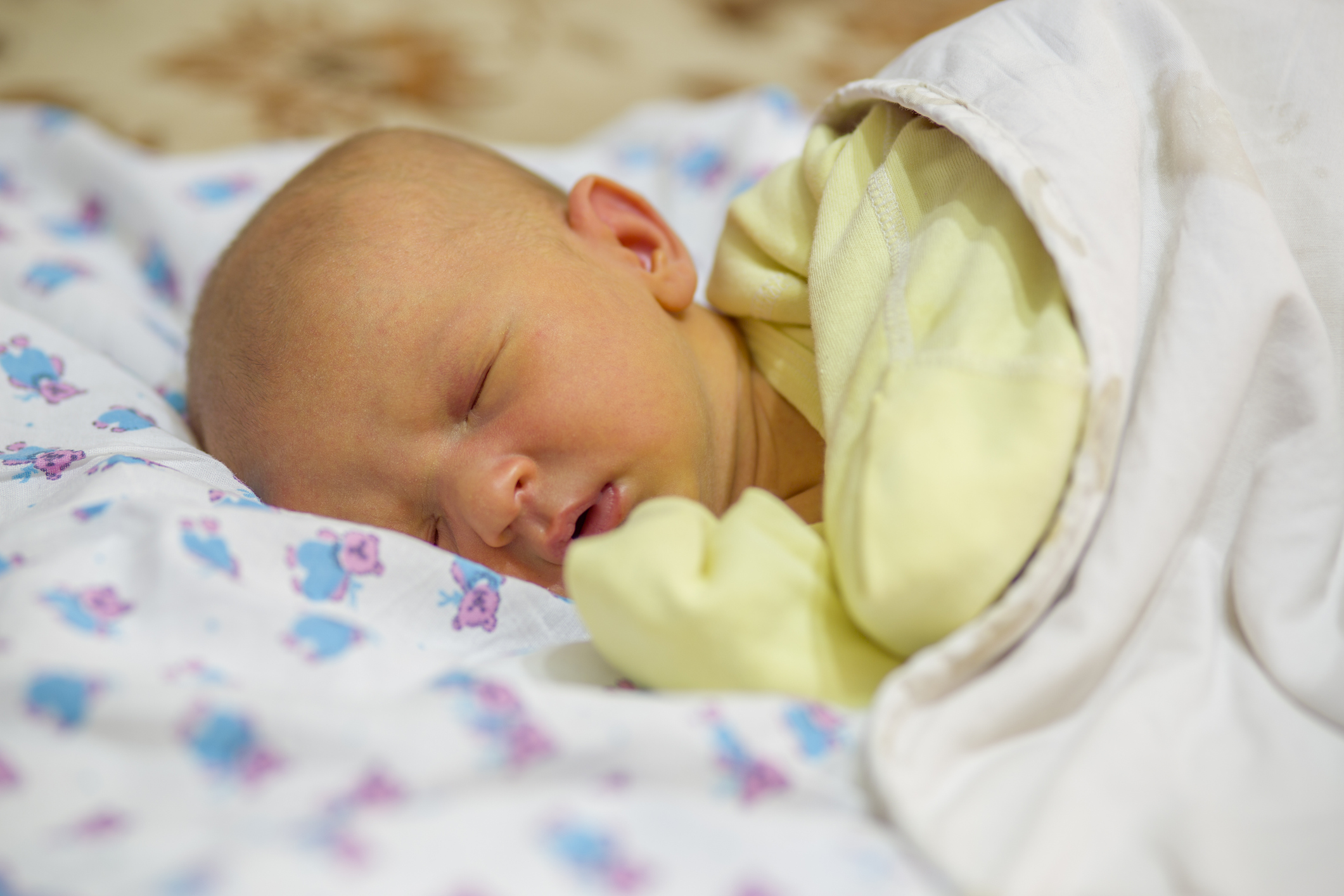 Gelbsucht bei Neugeborenen: Wenn der Ikterus Eltern besorgt